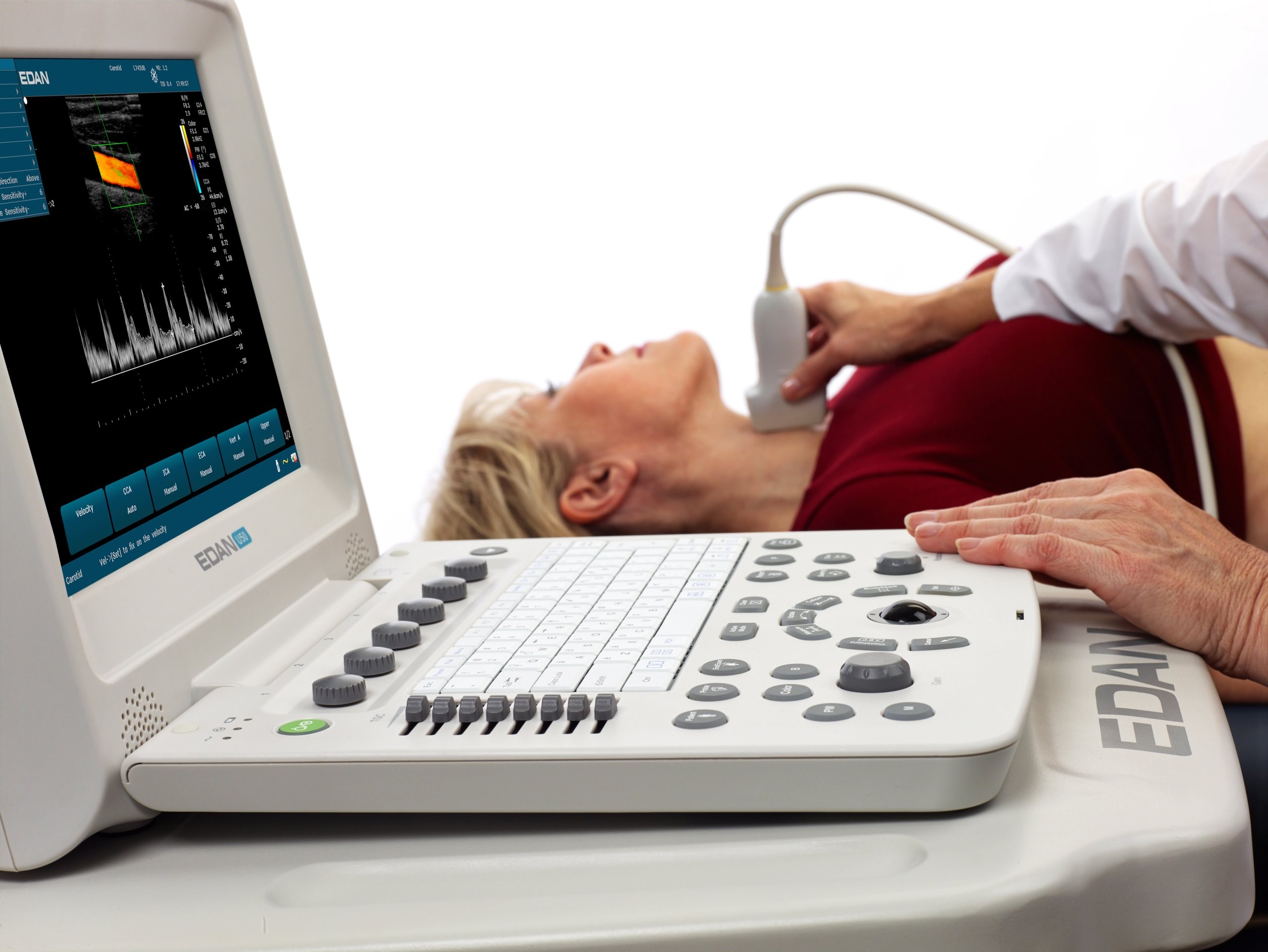 УЗИ на дому